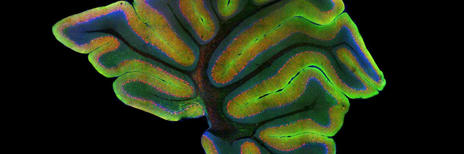 Laser scanning confocal image of a mouse cerebellum.